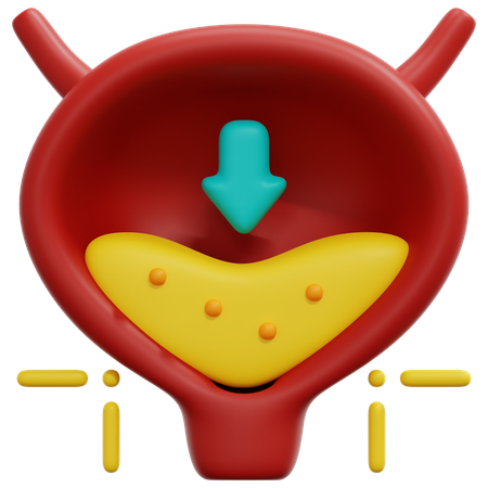 방광염  3D Icon