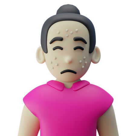Akne im Gesicht  3D Icon