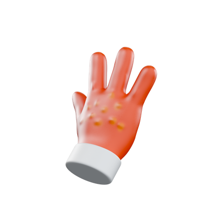 Alergia às mãos  3D Illustration