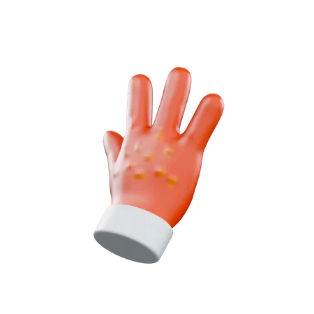 Alergia a las manos  3D Illustration