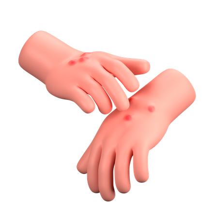 Alérgico  3D Icon