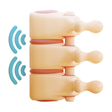 Spondylitis ankylosans  3D Icon