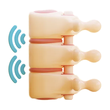 Spondylitis ankylosans  3D Icon