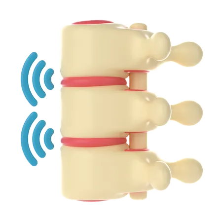 Ankylosing spondylitis Spine  3D Icon