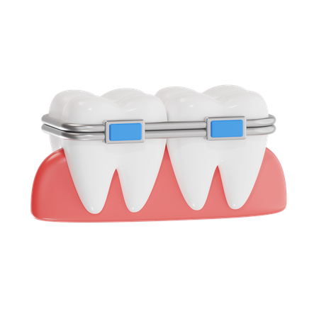 Brackets dentales  3D Icon