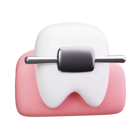 Aparatos dentales  3D Icon