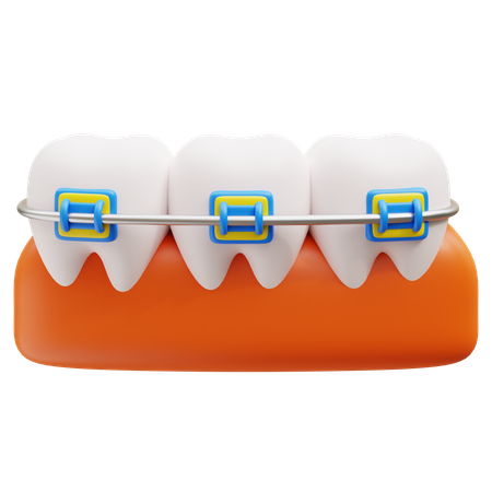 Brackets dentales  3D Icon