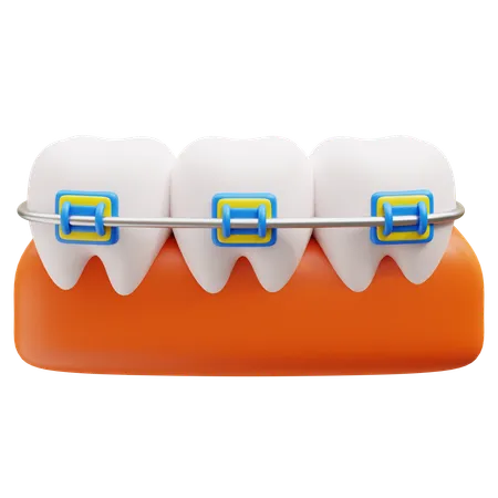 Brackets dentales  3D Icon