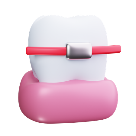 Apoyos dientes  3D Icon