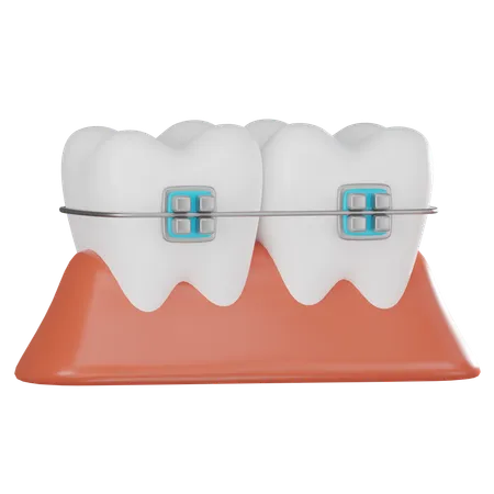 Brackets dentales  3D Icon