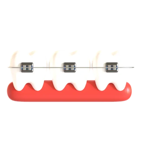 Aparatos dentales  3D Icon