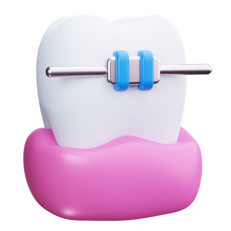 Brackets dentales  3D Icon