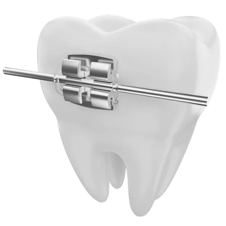 Brackets dentales  3D Illustration