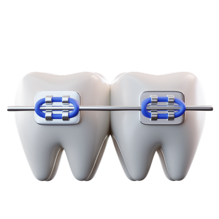 Aparelho ortodôntico  3D Icon
