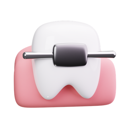 Aparelho dentário  3D Icon