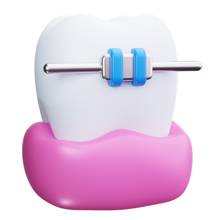 Aparelho dentário  3D Icon