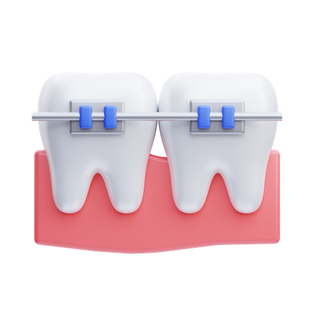 Aparelho ortodôntico nos dentes  3D Icon