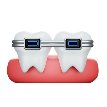 Aparelho dentário  3D Icon