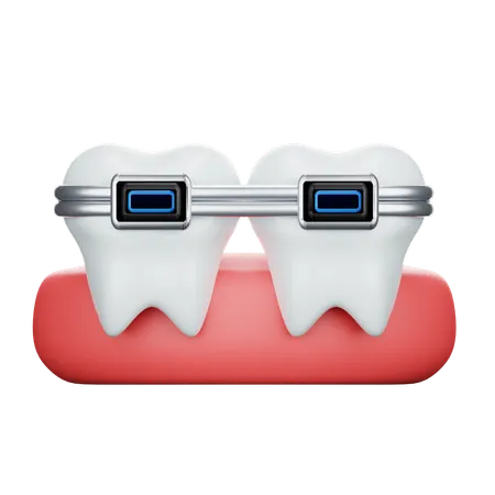 Aparelho dentário  3D Icon