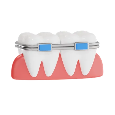 Aparelho dentário  3D Icon