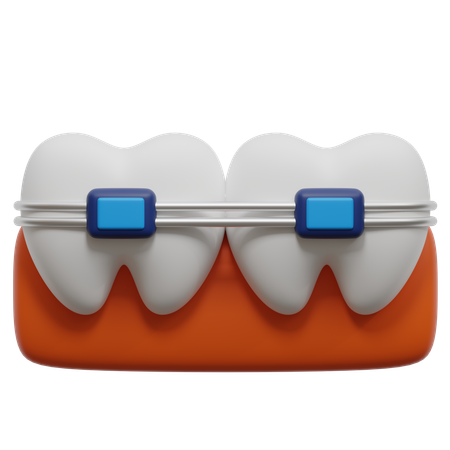 Aparelho dentário  3D Icon