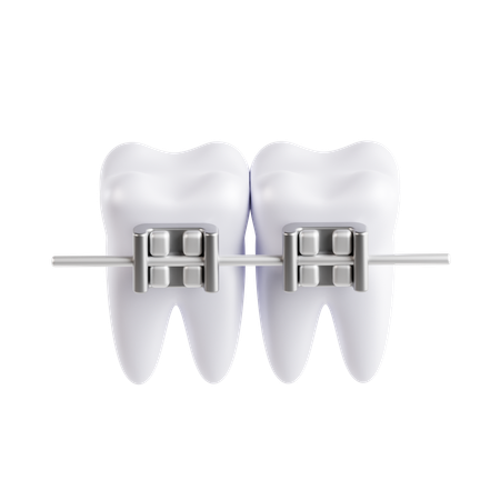 Aparelho dentário  3D Icon