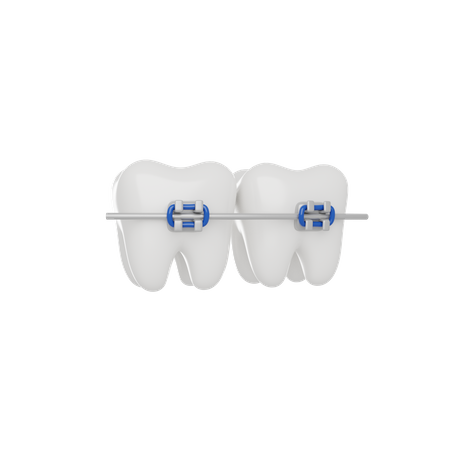 Aparelho dentário  3D Icon