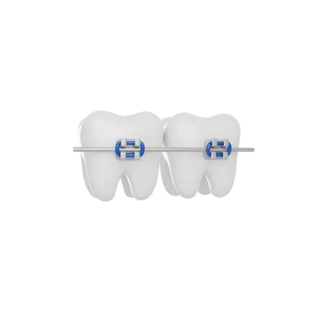 Aparelho dentário  3D Icon