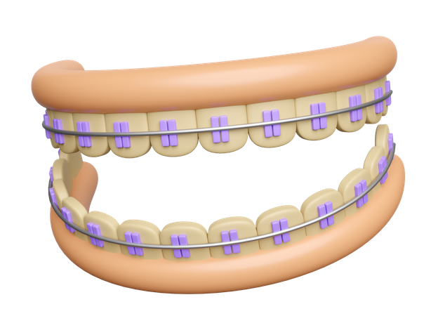 Aparelho dentário com goma  3D Illustration