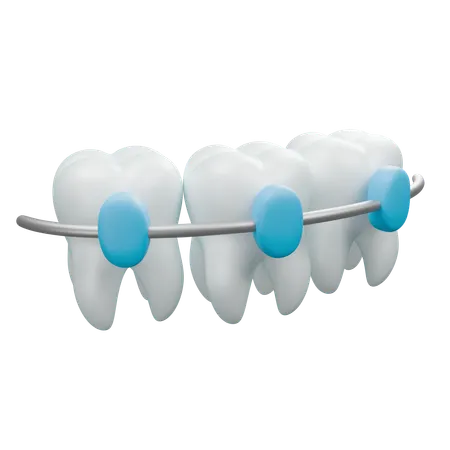 Aparelho dentário  3D Icon