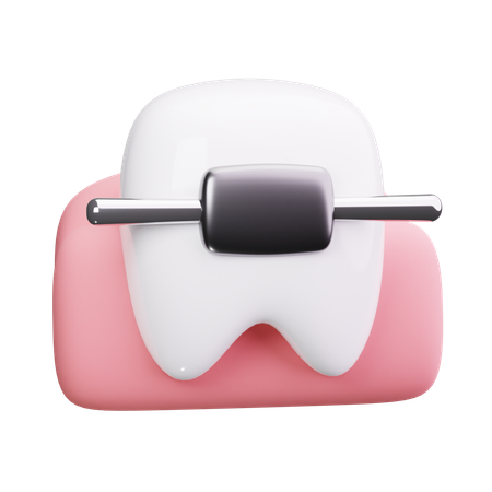 Appareil dentaire  3D Icon