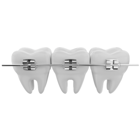 Appareils dentaires  3D Icon