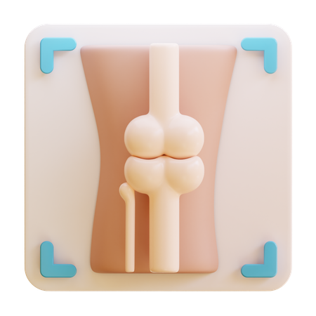 Arthritis-Röntgenbild  3D Icon