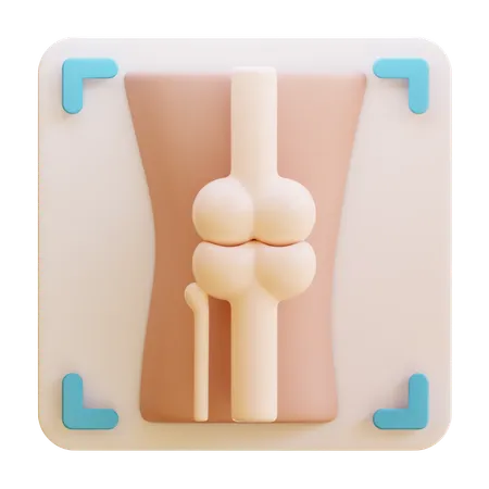 Arthritis-Röntgenbild  3D Icon