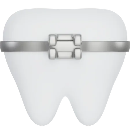 Avoir un appareil dentaire  3D Icon