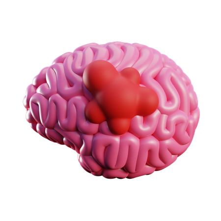 Big Brain Tumor  3D Icon