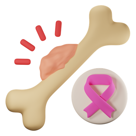 Bone cancer  3D Icon