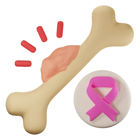 Bone cancer  3D Icon