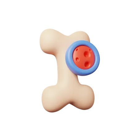 Bone Cancer  3D Icon