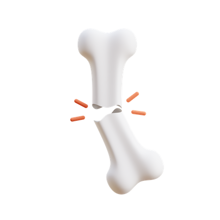 Bone Fracture  3D Icon