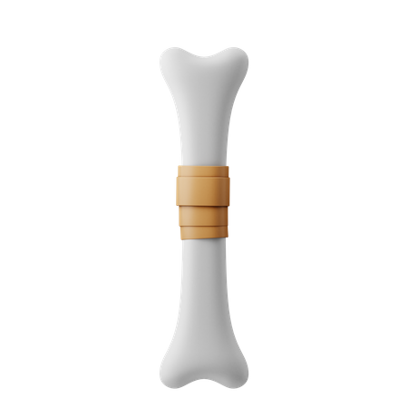 Bone Fracture Recovery  3D Illustration