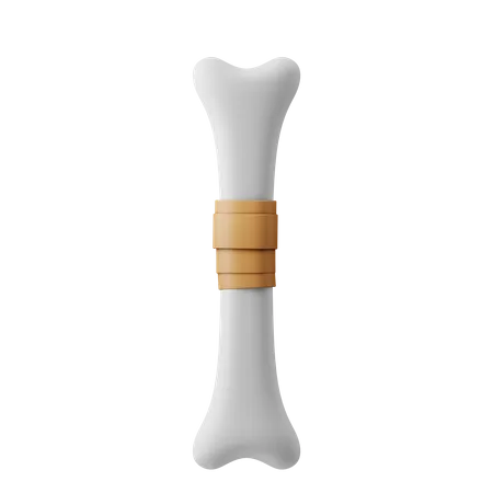 Bone Fracture Recovery  3D Illustration