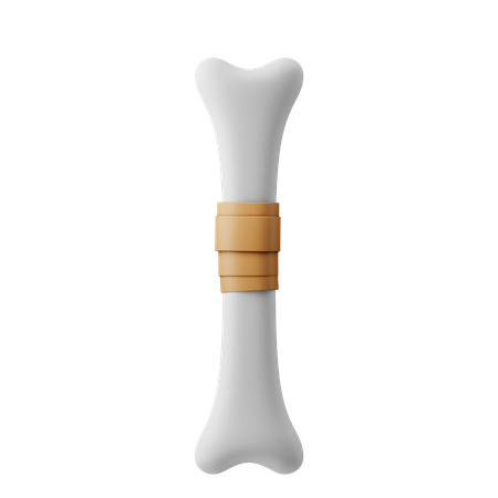 Bone Fracture Recovery 3D Illustration