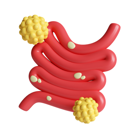 Bowel cancer  3D Icon