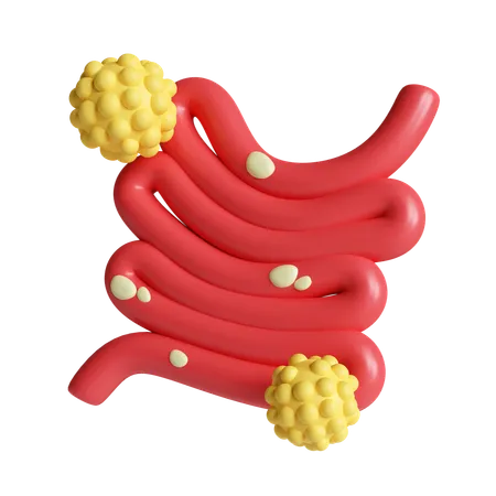 Bowel cancer  3D Icon