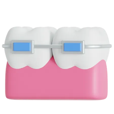 Teeth With Braces 3D Icon