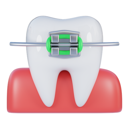 Braces  3D Icon