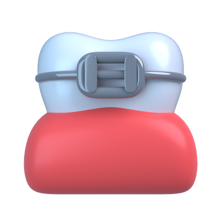 Braces  3D Icon