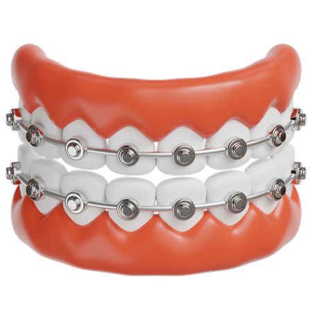 Braces  3D Icon