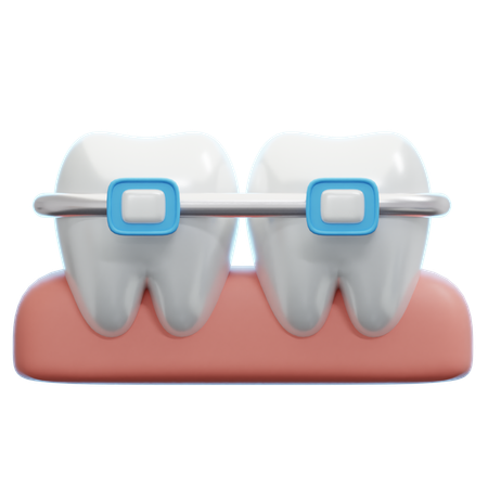 Braces  3D Icon